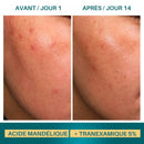 Sérum Haute Puissance Acide Mandélique + Tranexamique 5% Botik 30ml JosikaBeauty